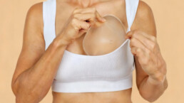 Recambio de prótesis mamaria