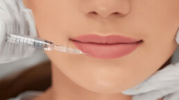 Tratamientos de labios con ácido hialurónico en Marbella