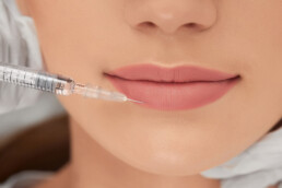 Tratamientos de labios con ácido hialurónico en Marbella